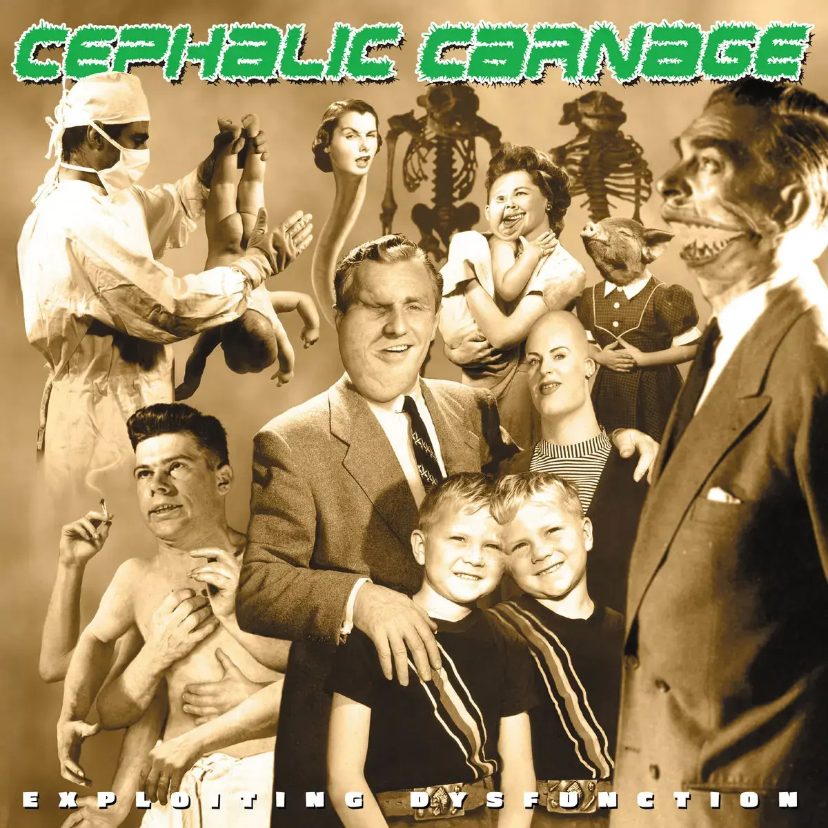 CEPHALIC CARNAGE - Exploiting Dysfunction (25th Anniversary) · GOLD/WHITE 2LP · Picture 1 CEPHALIC CARNAGE - Exploiting Dysfunction (25th Anniversary) · GOLD/WHITE 2LP (Death Metal Vinyl) · Picture 1